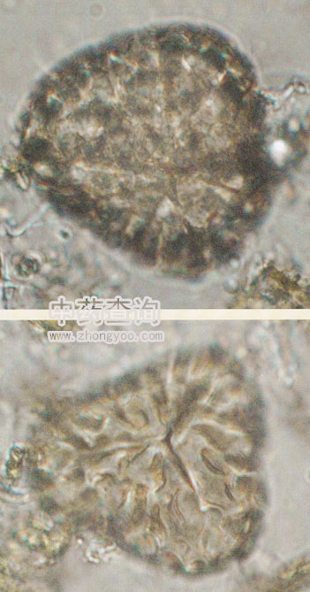 海金沙混淆品孢子顯微特征放大圖