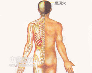 后頂穴位